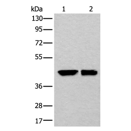 DLK1 Antibody from Signalway Antibody (43875) - Antibodies.com