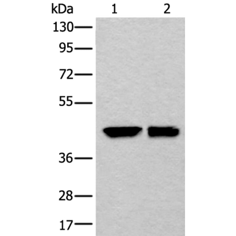 DLK1 Antibody from Signalway Antibody (43875) - Antibodies.com