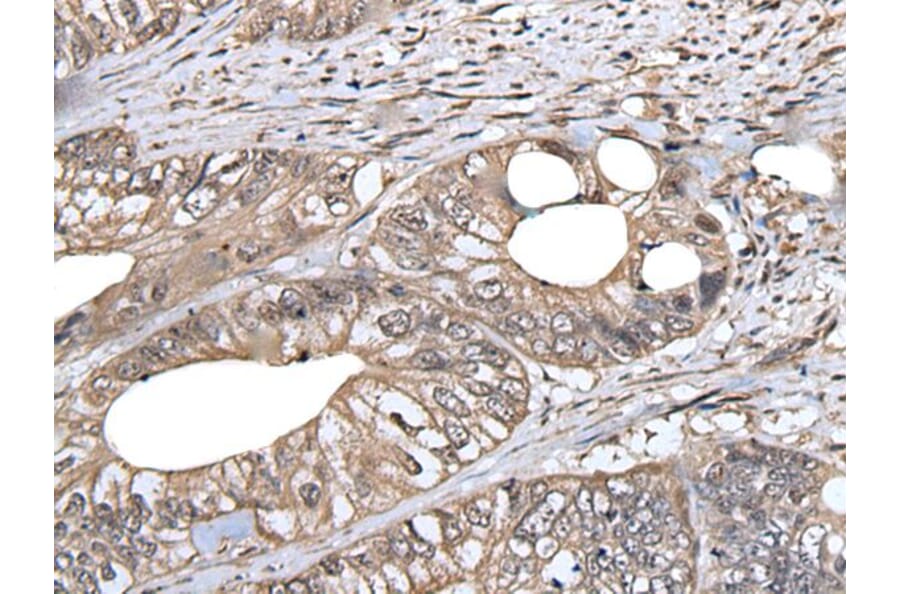 DLK1 Antibody from Signalway Antibody (43875) - Antibodies.com