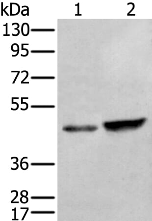 Gel: 8% SDS-PAGE Lysate: 40 &#956;g, Lane 1-2: HUVEC and Hela cell lysates, Primary antibody: ZNF24 antibody at dilution 1/350, Secondary antibody: Goat anti rabbit IgG at 1/8000 dilution, Exposure time: 10 seconds