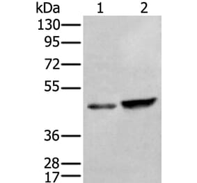 ZNF24 Antibody from Signalway Antibody (43889) - Antibodies.com