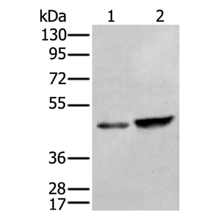 ZNF24 Antibody from Signalway Antibody (43889) - Antibodies.com