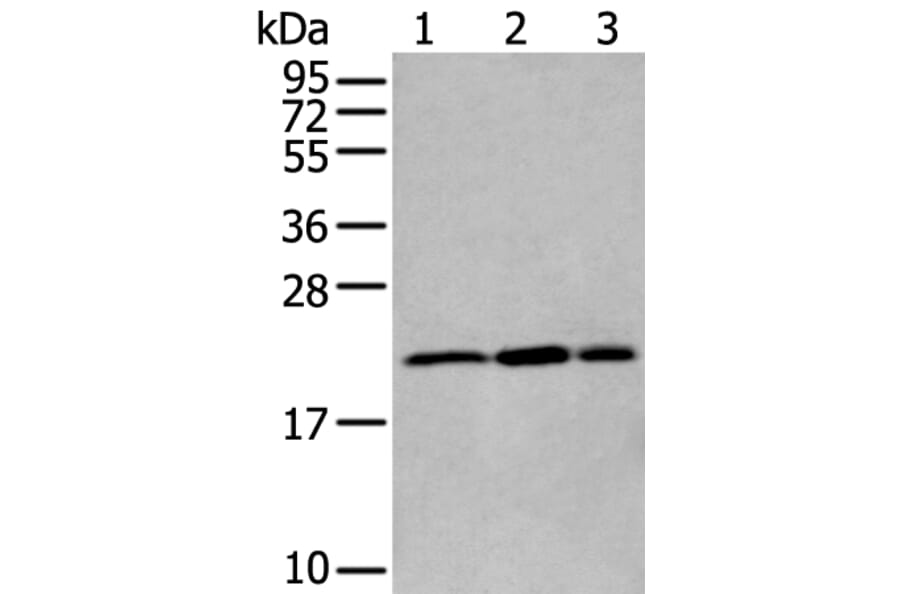 RBM8A Antibody from Signalway Antibody (43894) - Antibodies.com