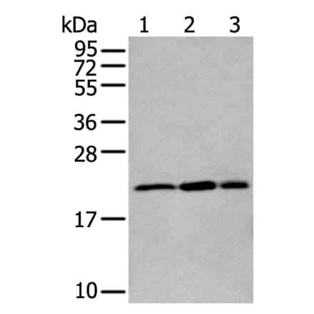 RBM8A Antibody from Signalway Antibody (43894) - Antibodies.com