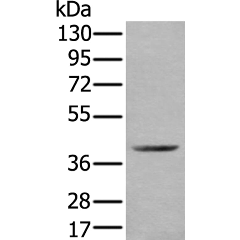 WDFY2 Antibody from Signalway Antibody (43896) - Antibodies.com