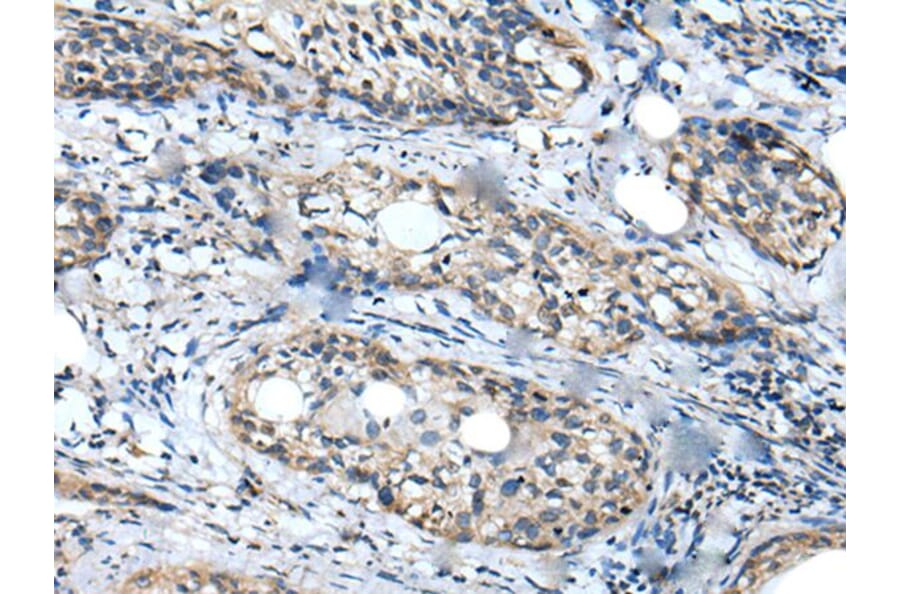 WDFY2 Antibody from Signalway Antibody (43896) - Antibodies.com