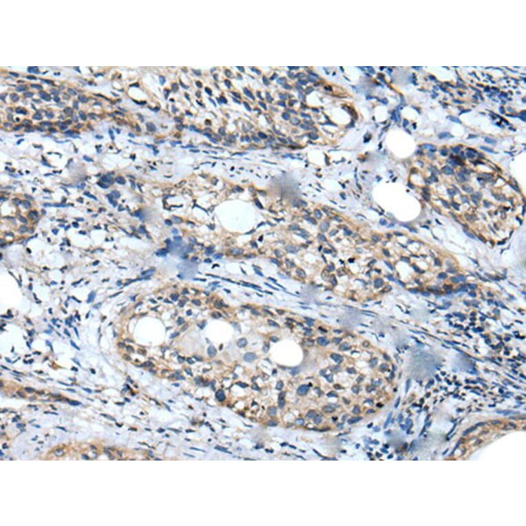 WDFY2 Antibody from Signalway Antibody (43896) - Antibodies.com