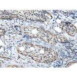 WDFY2 Antibody from Signalway Antibody (43896) - Antibodies.com