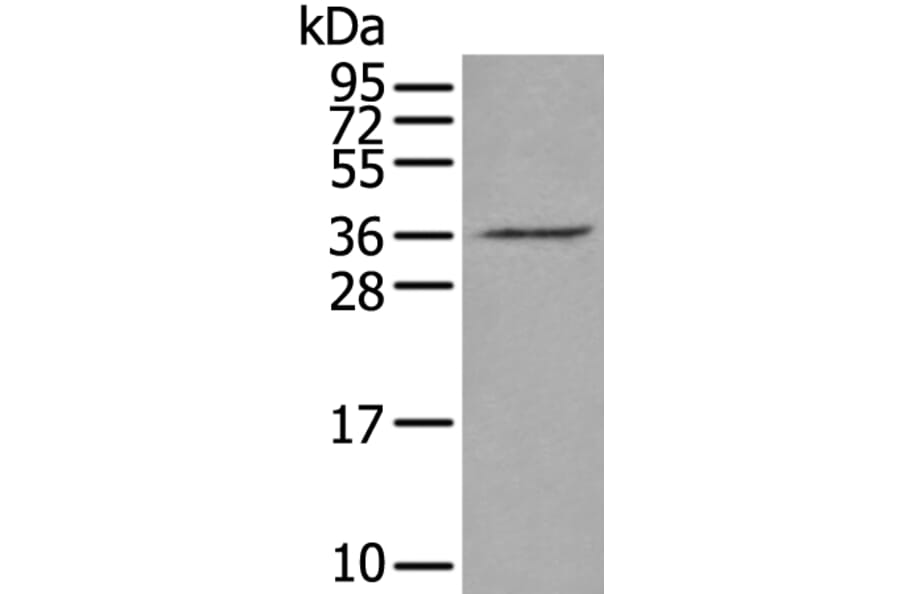 VGLL2 Antibody from Signalway Antibody (43898) - Antibodies.com