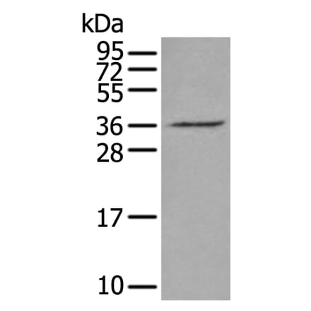 VGLL2 Antibody from Signalway Antibody (43898) - Antibodies.com