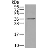VGLL2 Antibody from Signalway Antibody (43898) - Antibodies.com