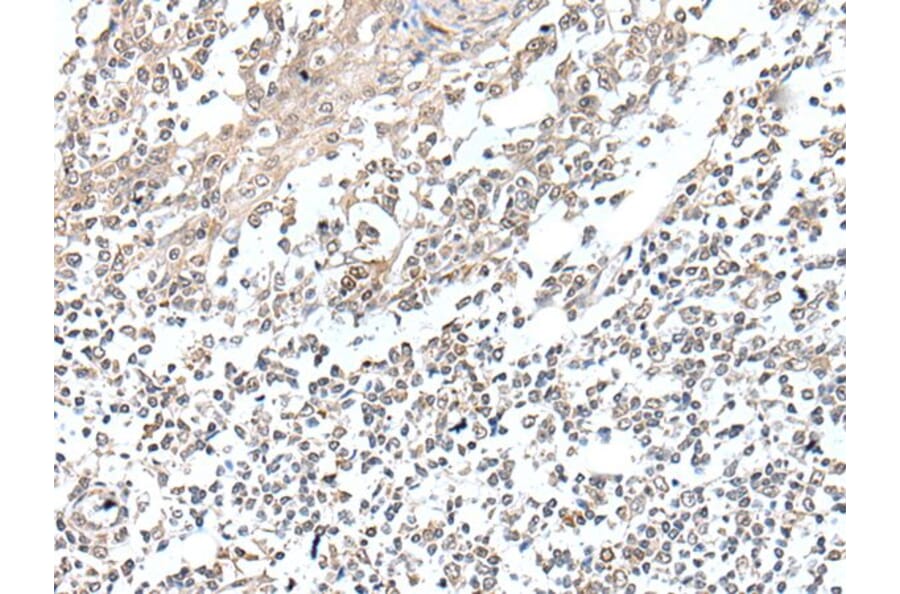 VGLL2 Antibody from Signalway Antibody (43898) - Antibodies.com