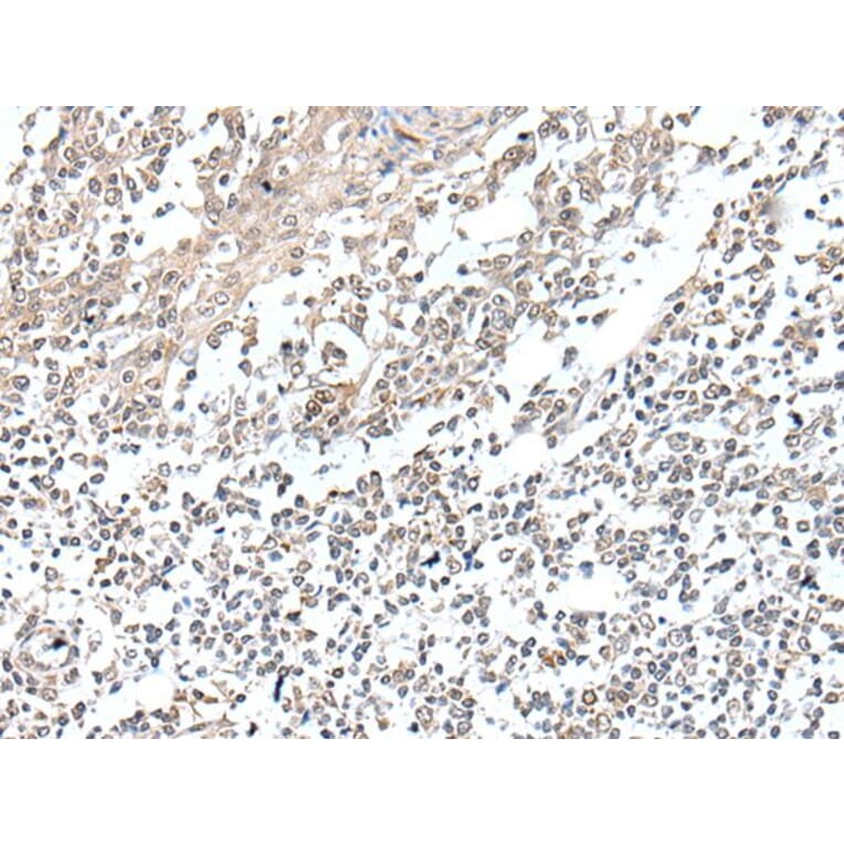 VGLL2 Antibody from Signalway Antibody (43898) - Antibodies.com