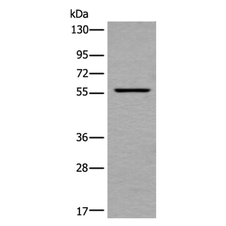 UBOX5 Antibody from Signalway Antibody (43900) - Antibodies.com