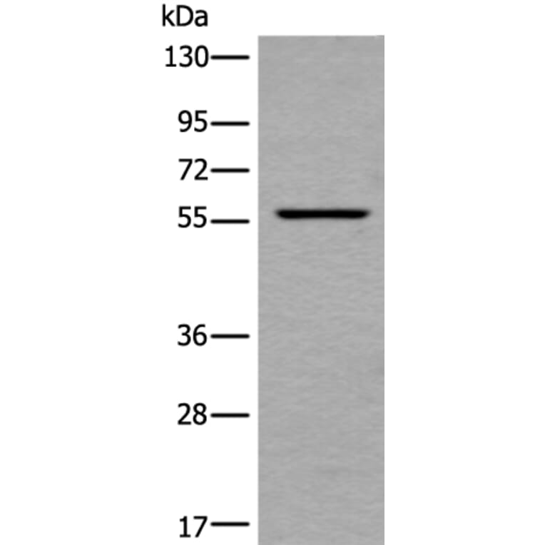 UBOX5 Antibody from Signalway Antibody (43900) - Antibodies.com