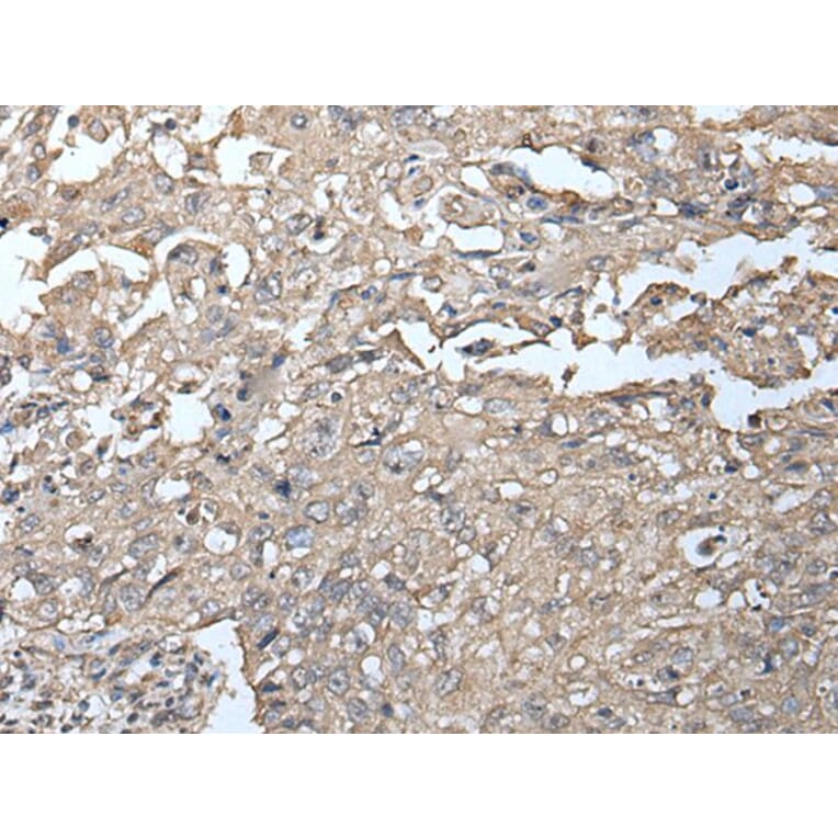 UBOX5 Antibody from Signalway Antibody (43900) - Antibodies.com