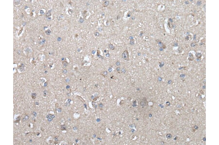 UBOX5 Antibody from Signalway Antibody (43900) - Antibodies.com