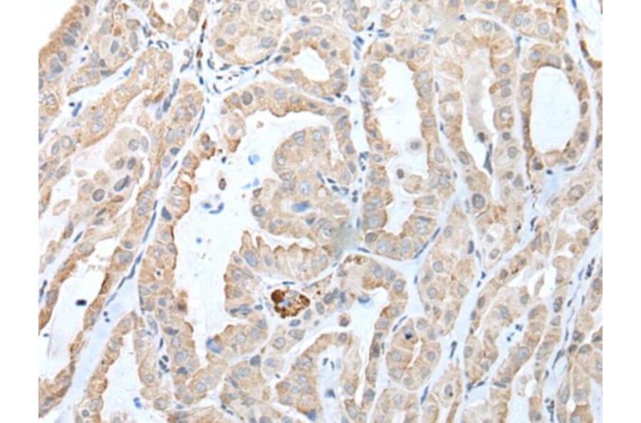 CCL14 Antibody from Signalway Antibody (43915) - Antibodies.com