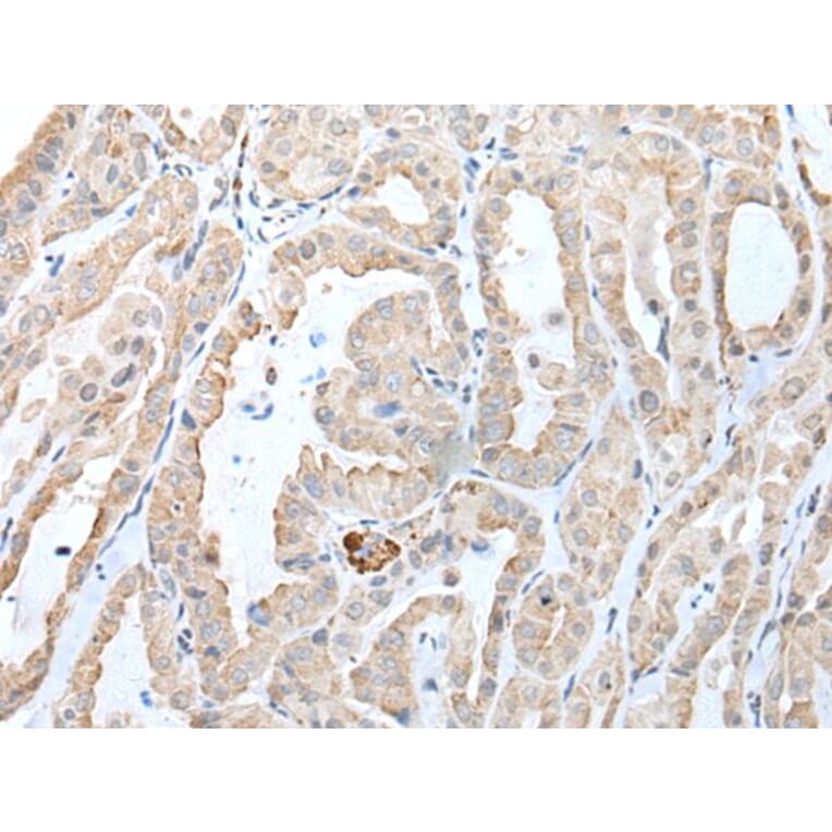 CCL14 Antibody from Signalway Antibody (43915) - Antibodies.com