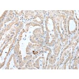 CCL14 Antibody from Signalway Antibody (43915) - Antibodies.com