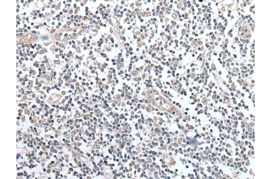 CCL14 Antibody from Signalway Antibody (43915) - Antibodies.com