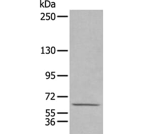 HPSE2 Antibody from Signalway Antibody (43928) - Antibodies.com