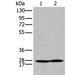 HOXA9 Antibody from Signalway Antibody (43930) - Antibodies.com