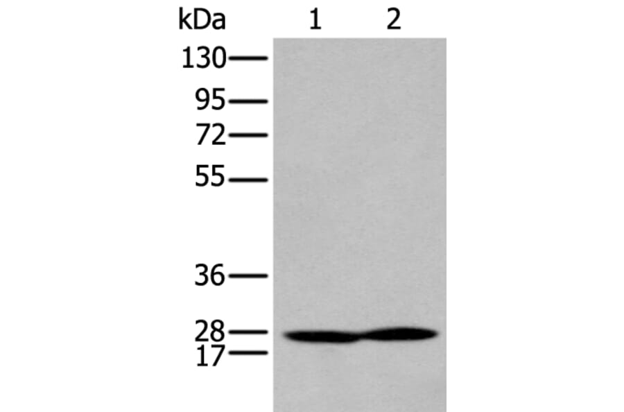 HOXA9 Antibody from Signalway Antibody (43930) - Antibodies.com