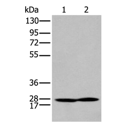 HOXA9 Antibody from Signalway Antibody (43930) - Antibodies.com