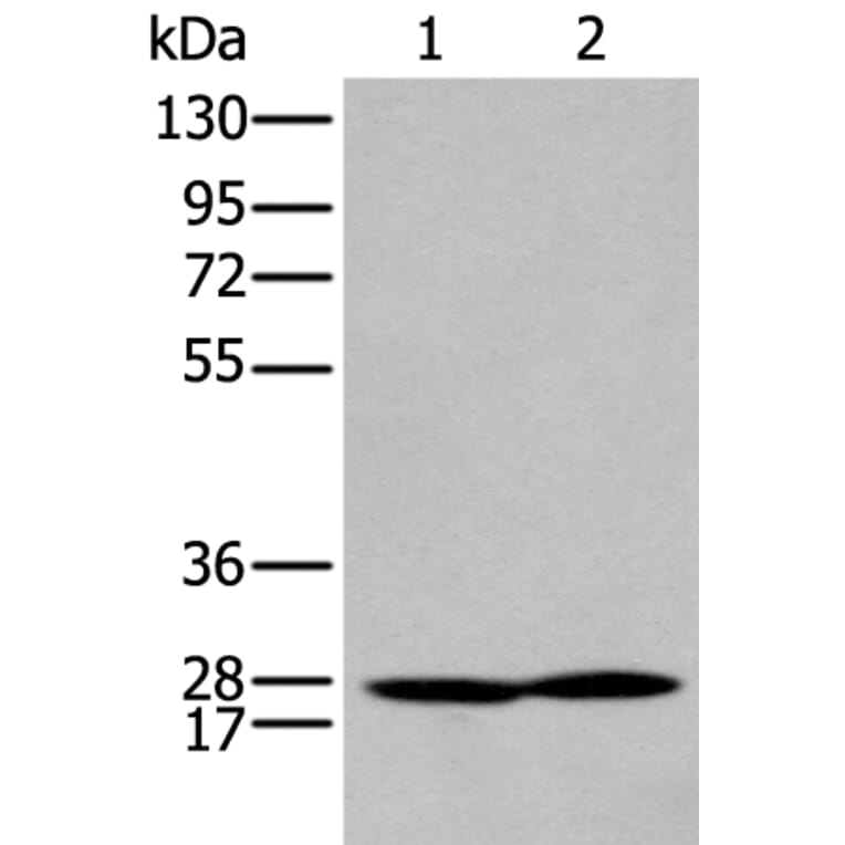 HOXA9 Antibody from Signalway Antibody (43930) - Antibodies.com