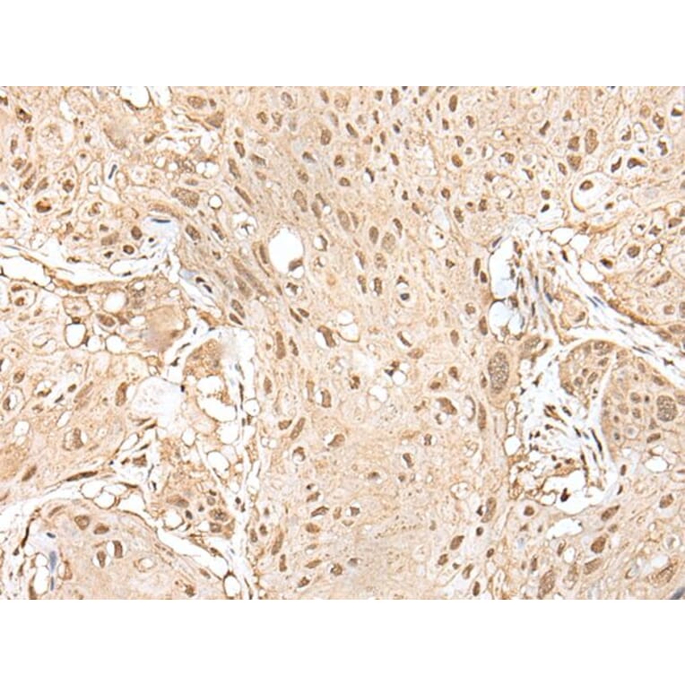 HOXA9 Antibody from Signalway Antibody (43930) - Antibodies.com