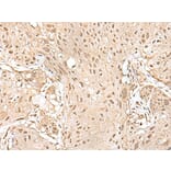 HOXA9 Antibody from Signalway Antibody (43930) - Antibodies.com