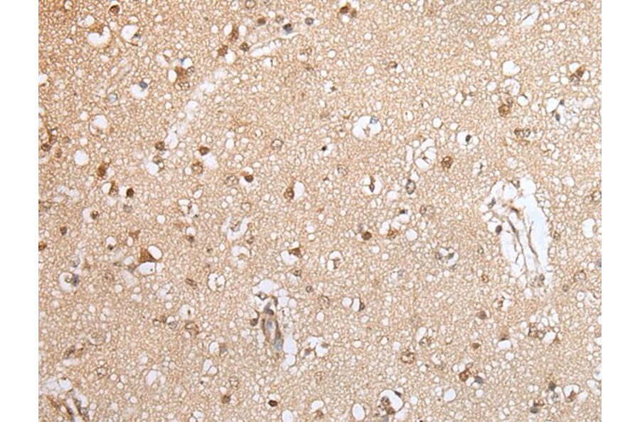 HOXA9 Antibody from Signalway Antibody (43930) - Antibodies.com