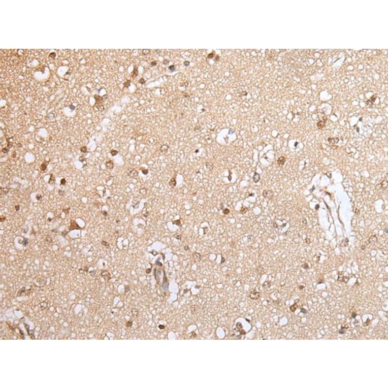 HOXA9 Antibody from Signalway Antibody (43930) - Antibodies.com