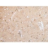 HOXA9 Antibody from Signalway Antibody (43930) - Antibodies.com