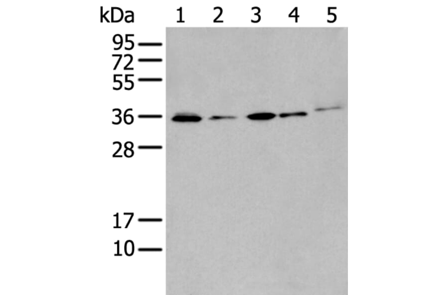 HOXC4 Antibody from Signalway Antibody (43943) - Antibodies.com