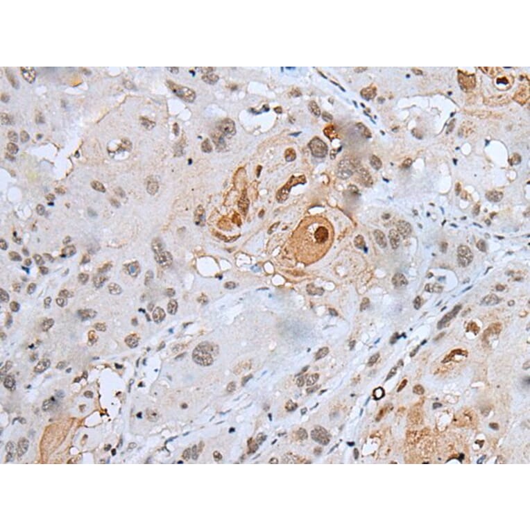 HOXC4 Antibody from Signalway Antibody (43943) - Antibodies.com