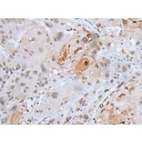 HOXC4 Antibody from Signalway Antibody (43943) - Antibodies.com