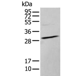 HOXC9 Antibody from Signalway Antibody (43944) - Antibodies.com