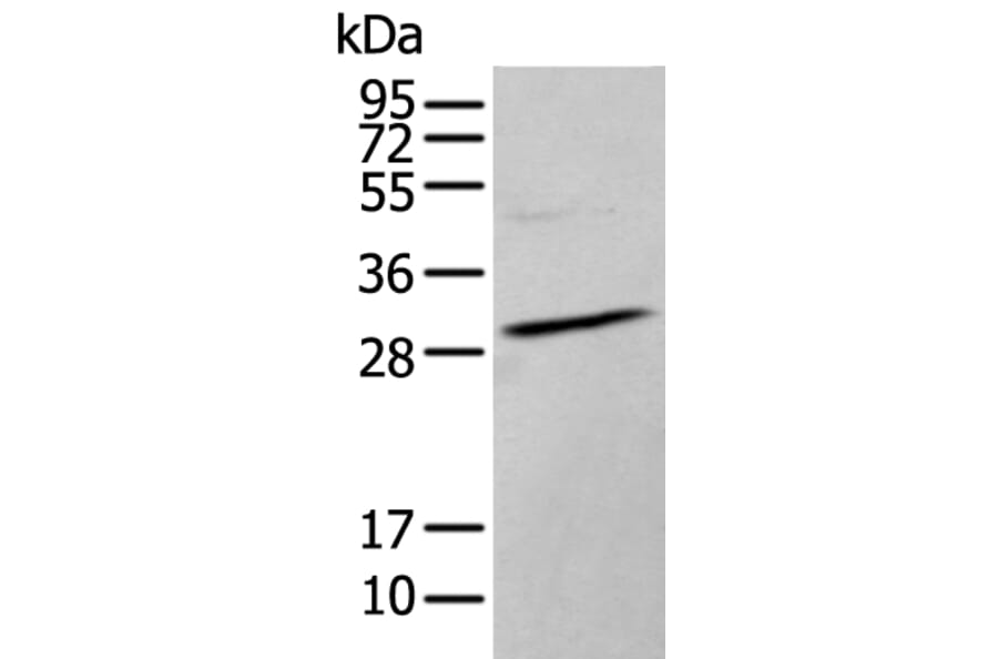HOXC9 Antibody from Signalway Antibody (43944) - Antibodies.com