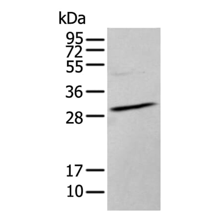 HOXC9 Antibody from Signalway Antibody (43944) - Antibodies.com