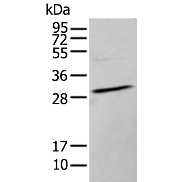HOXC9 Antibody from Signalway Antibody (43944) - Antibodies.com