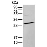 HOXC9 Antibody from Signalway Antibody (43944) - Antibodies.com