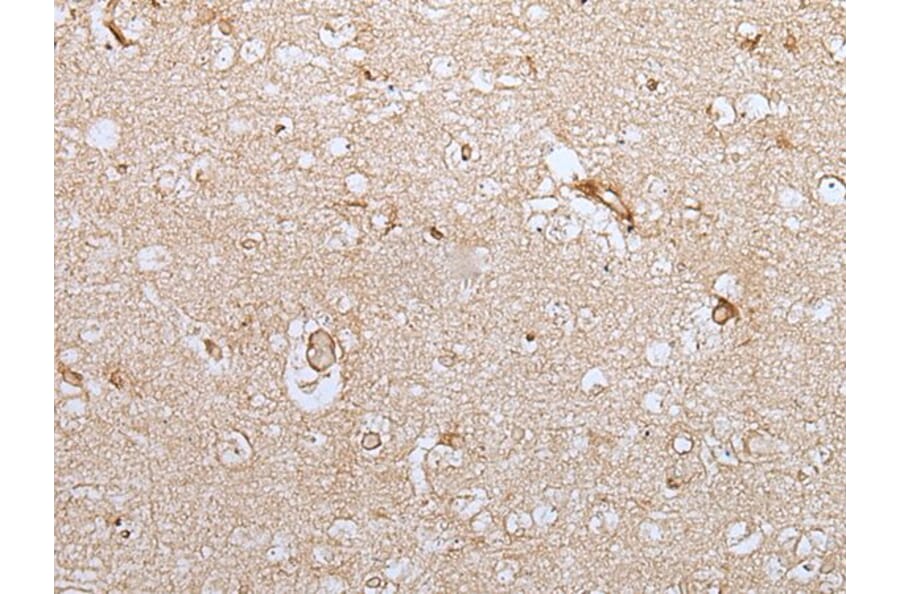 HOXC9 Antibody from Signalway Antibody (43944) - Antibodies.com