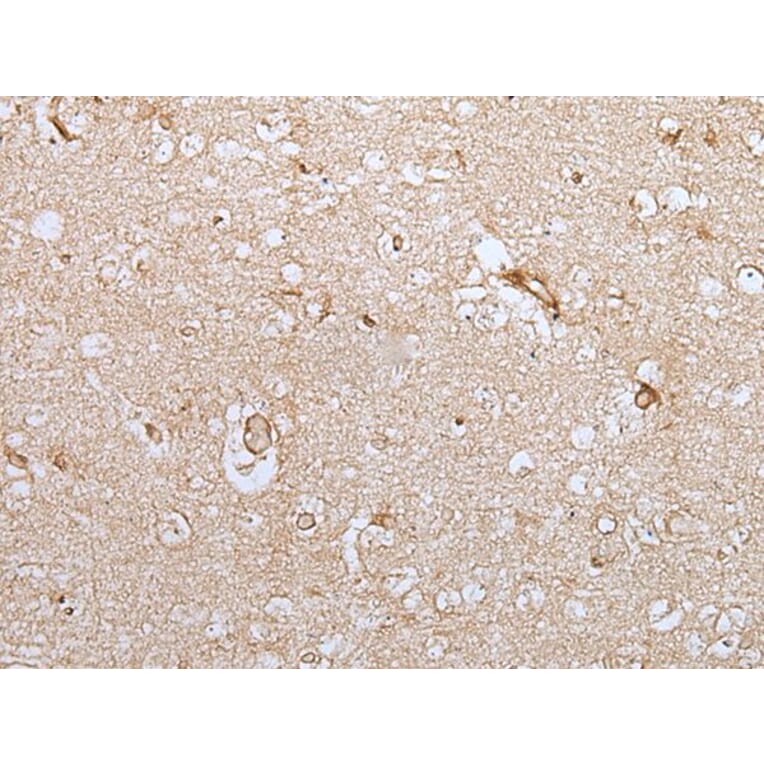 HOXC9 Antibody from Signalway Antibody (43944) - Antibodies.com