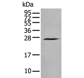 HAND1 Antibody from Signalway Antibody (43962) - Antibodies.com