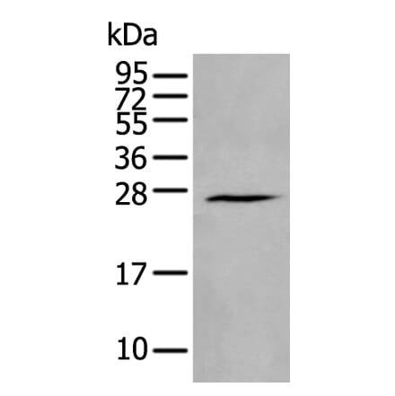 HAND1 Antibody from Signalway Antibody (43962) - Antibodies.com