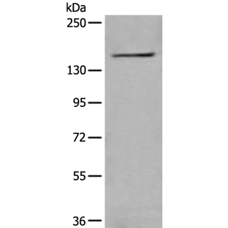 WDR11 Antibody from Signalway Antibody (43976) - Antibodies.com