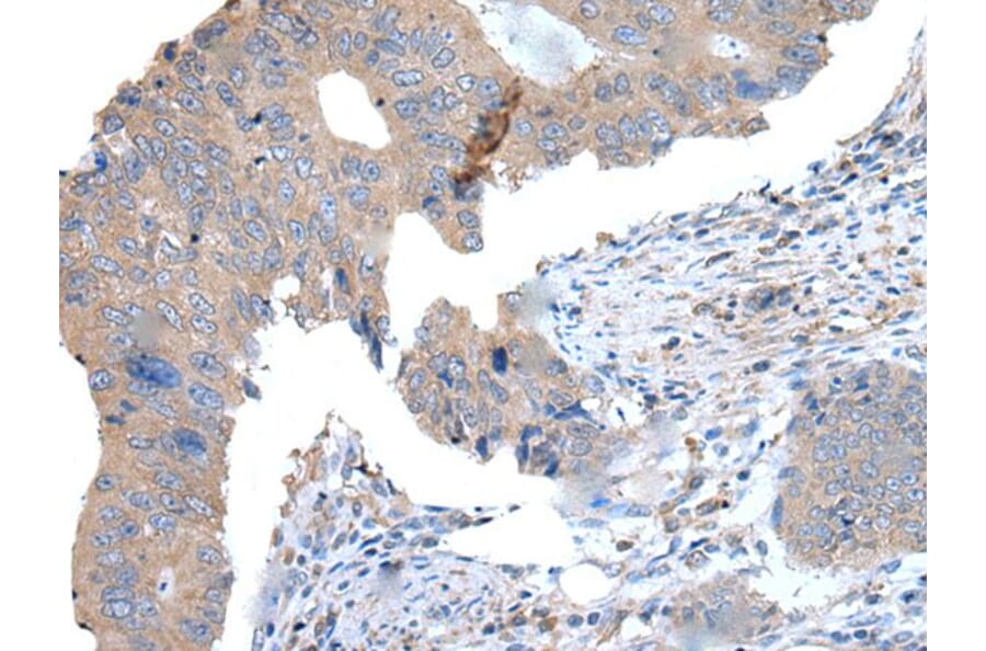 WDR11 Antibody from Signalway Antibody (43976) - Antibodies.com