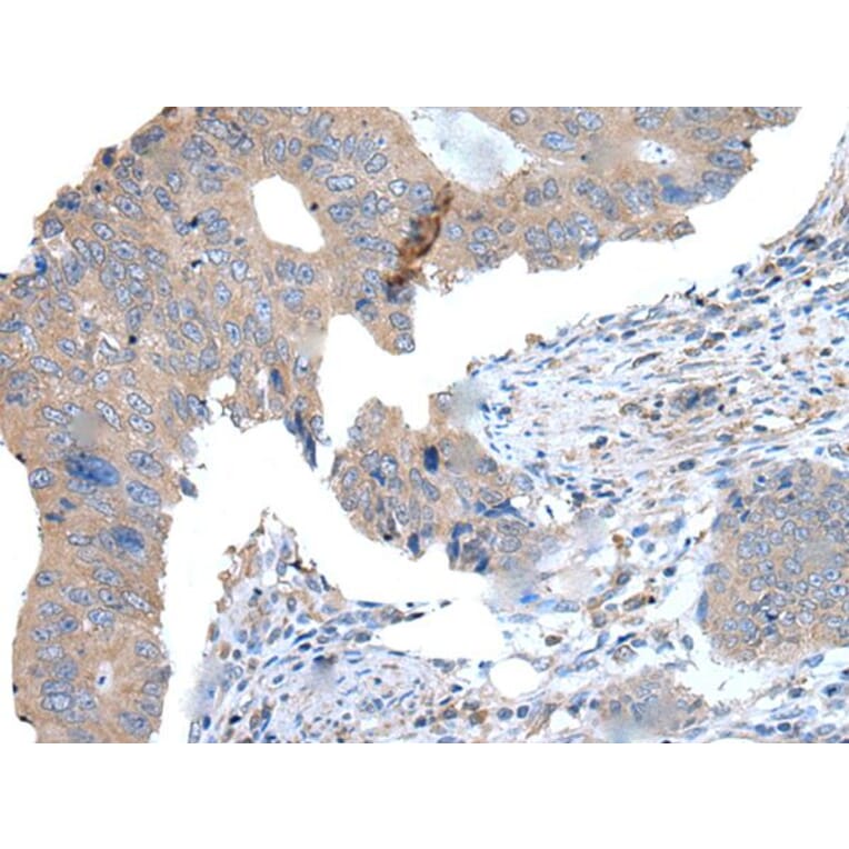 WDR11 Antibody from Signalway Antibody (43976) - Antibodies.com
